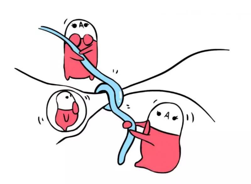男性结扎手术更有利于恢复健康